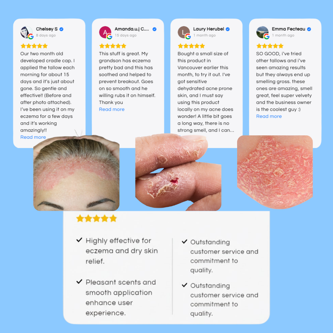 Infographic of five-star customer reviews for Premium Tallow products. Displays transformative results for skin inflammation and eczema, emphasizing commitment to quality and natural Canadian-made skincare